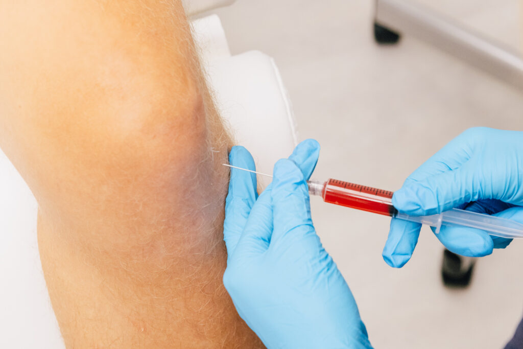 A top regenerative doctor in Mishawaka makes a joint injection.