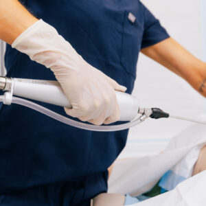 A provider uses tumescent liposuction for breast sculpting in Mishawaka