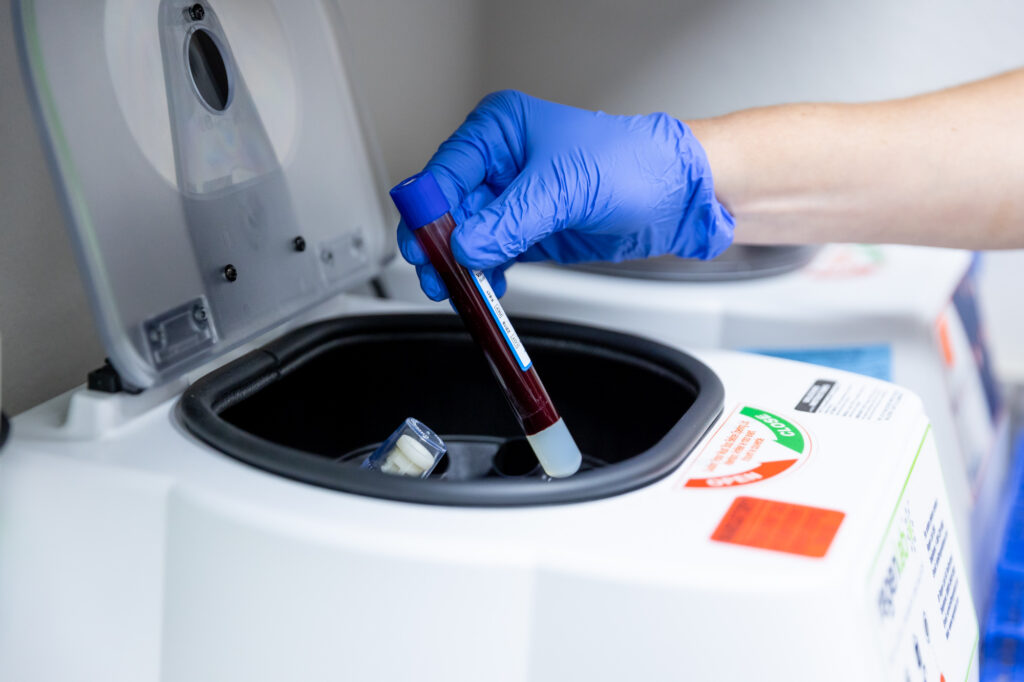 A regenerative medicine doctor in Mishawaka prepares a PRP injection